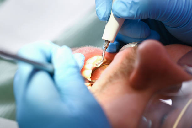 Best Pediatric Emergency Dentist in Patterson, CA