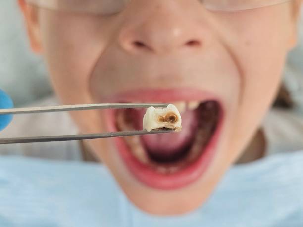 Best Same-Day Emergency Dentist in Patterson, CA